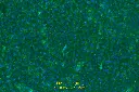 cd31-100x(1).webp