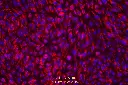 vWF-200x(1).webp